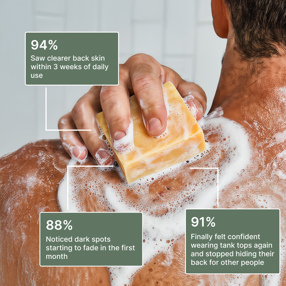 Back Acne & Dark Spot Relief Soap Bar