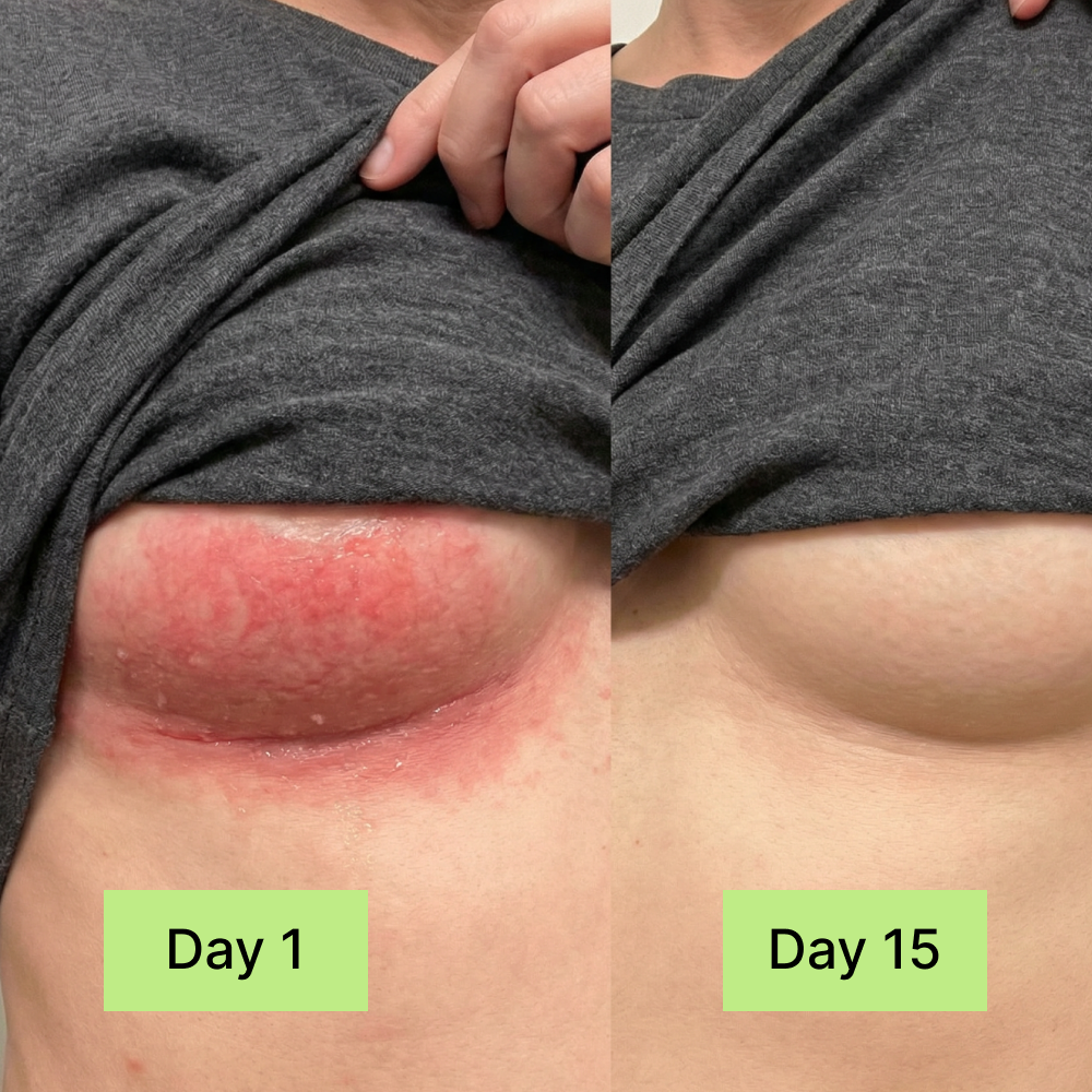 Clinical Antifungal Soap