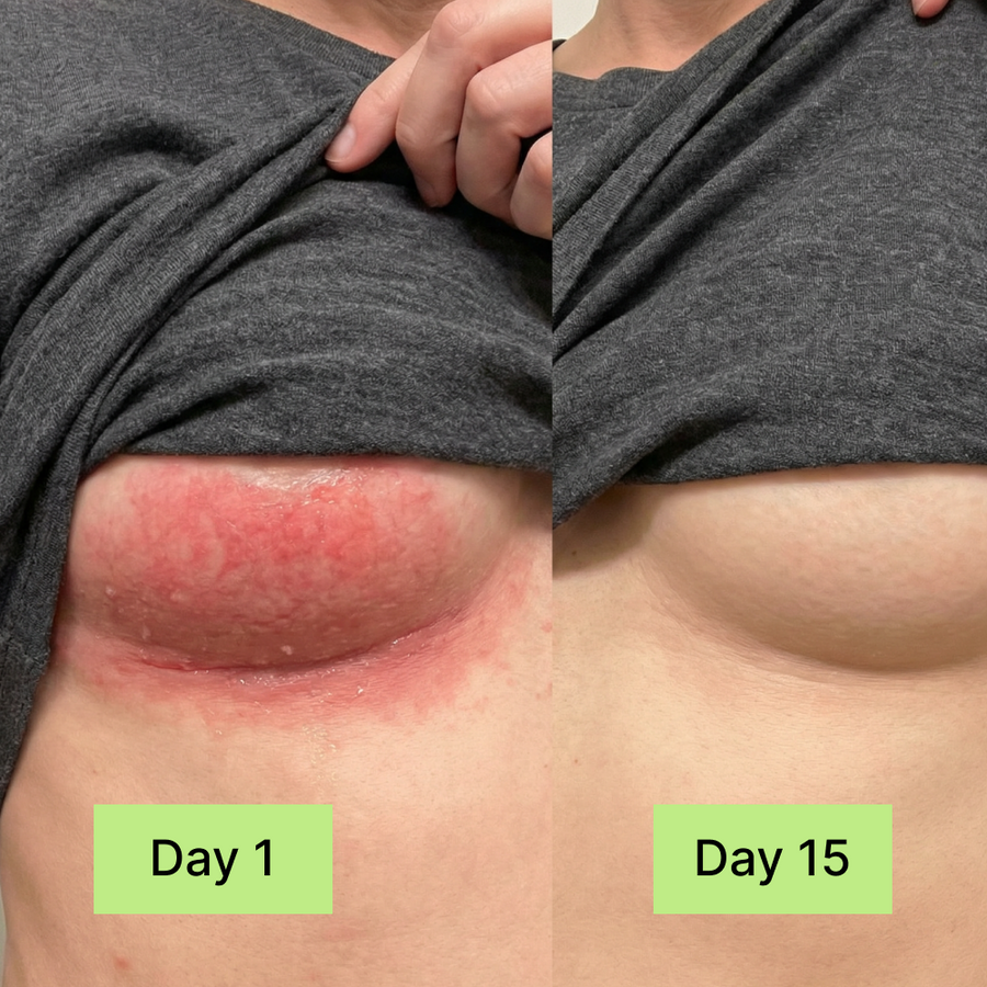 Clinical Antifungal Soap