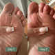 Clinical Antifungal Soap